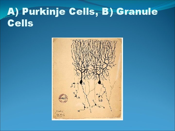 A) Purkinje Cells, B) Granule Cells 