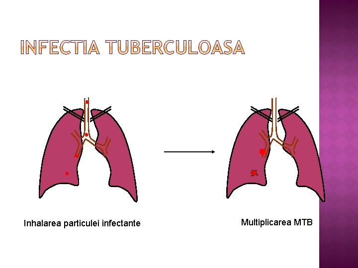 Inhalarea particulei infectante Multiplicarea MTB 