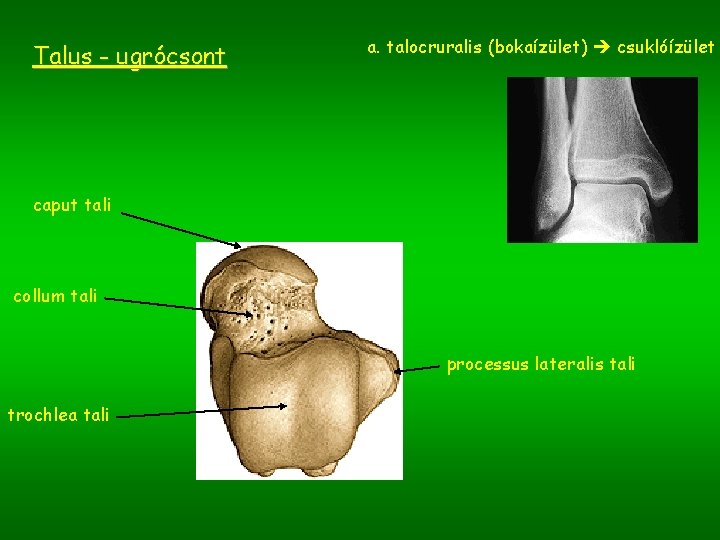 Talus - ugrócsont a. talocruralis (bokaízület) csuklóízület caput tali collum tali processus lateralis tali