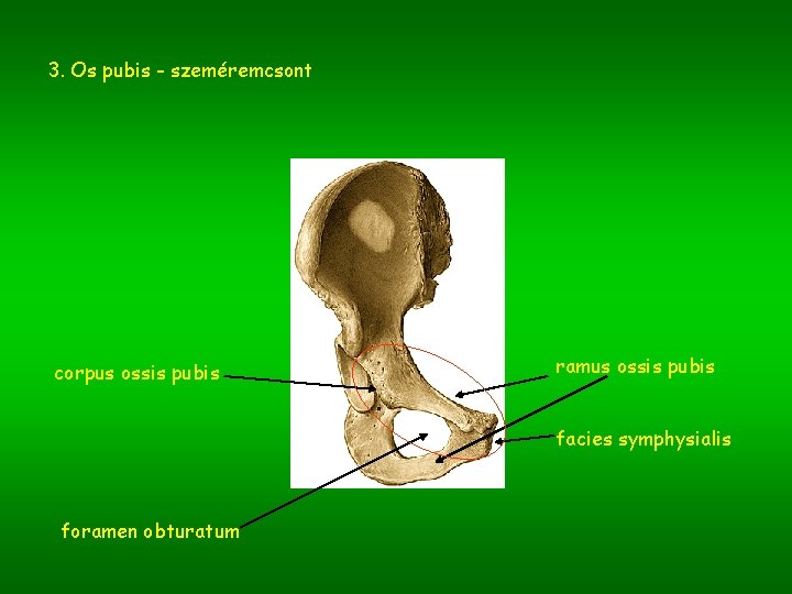 3. Os pubis - szeméremcsont corpus ossis pubis ramus ossis pubis facies symphysialis foramen