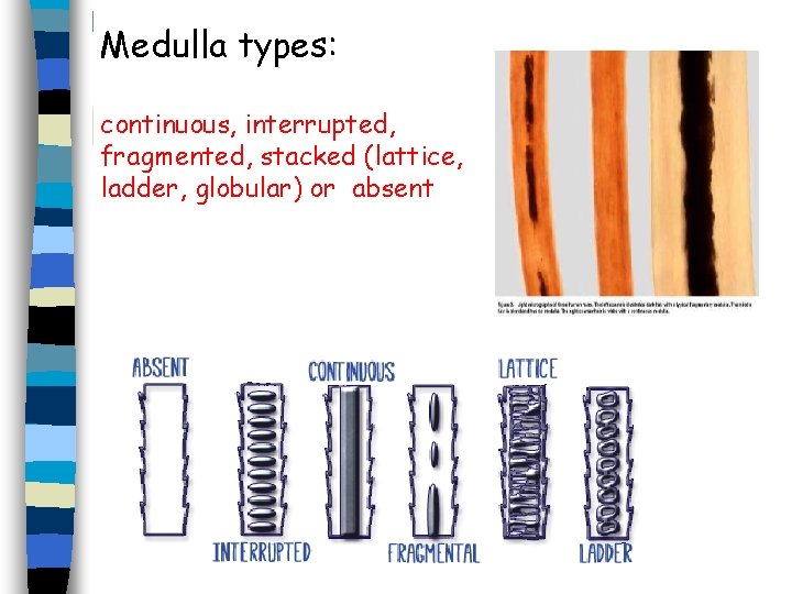 Medulla types: continuous, interrupted, fragmented, stacked (lattice, ladder, globular) or absent Medulla types: continuous, interrupted, fragmented, stacked (lattice, ladder, globular) or absent