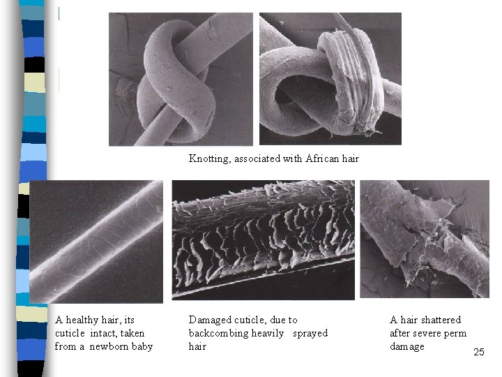 Knotting, associated with African hair A healthy hair, its cuticle intact, taken from a Knotting, associated with African hair A healthy hair, its cuticle intact, taken from a
