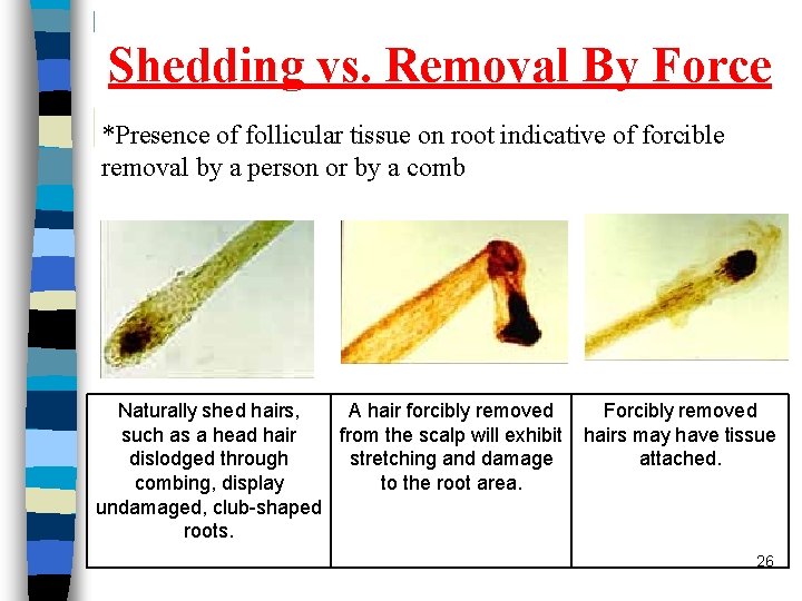 Shedding vs. Removal By Force *Presence of follicular tissue on root indicative of forcible Shedding vs. Removal By Force *Presence of follicular tissue on root indicative of forcible