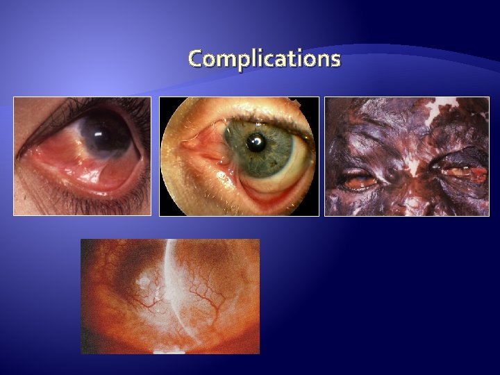 Complications 