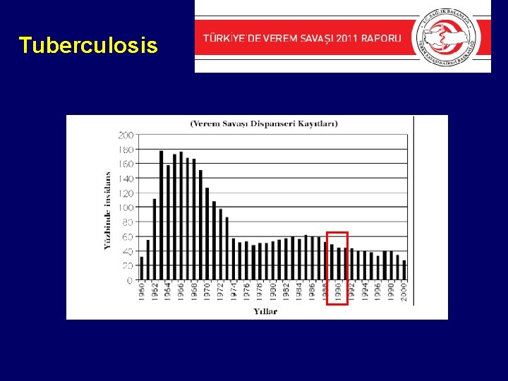 Tuberculosis 