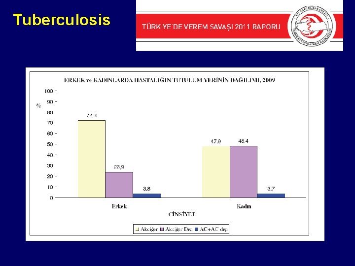 Tuberculosis 