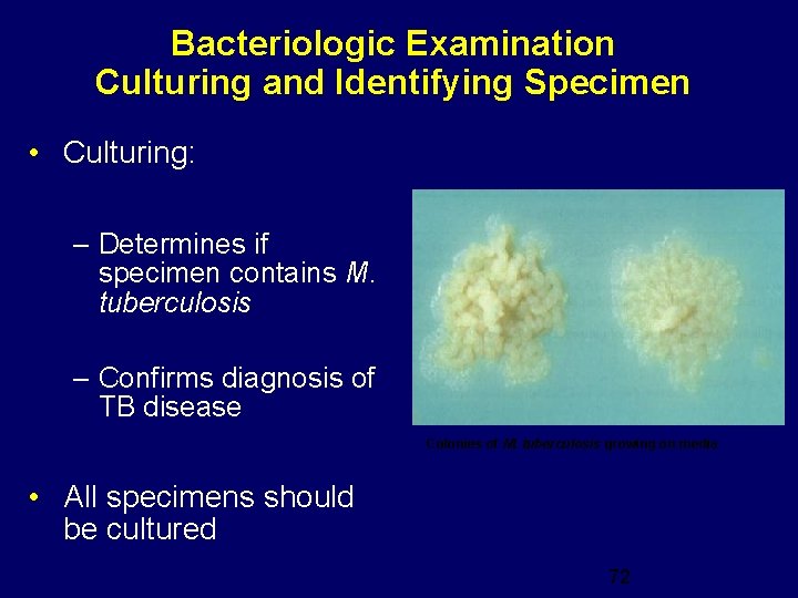 Bacteriologic Examination Culturing and Identifying Specimen • Culturing: – Determines if specimen contains M.