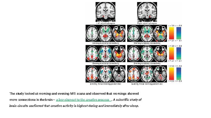 The study looked at morning and evening MRI scans and observed that mornings showed