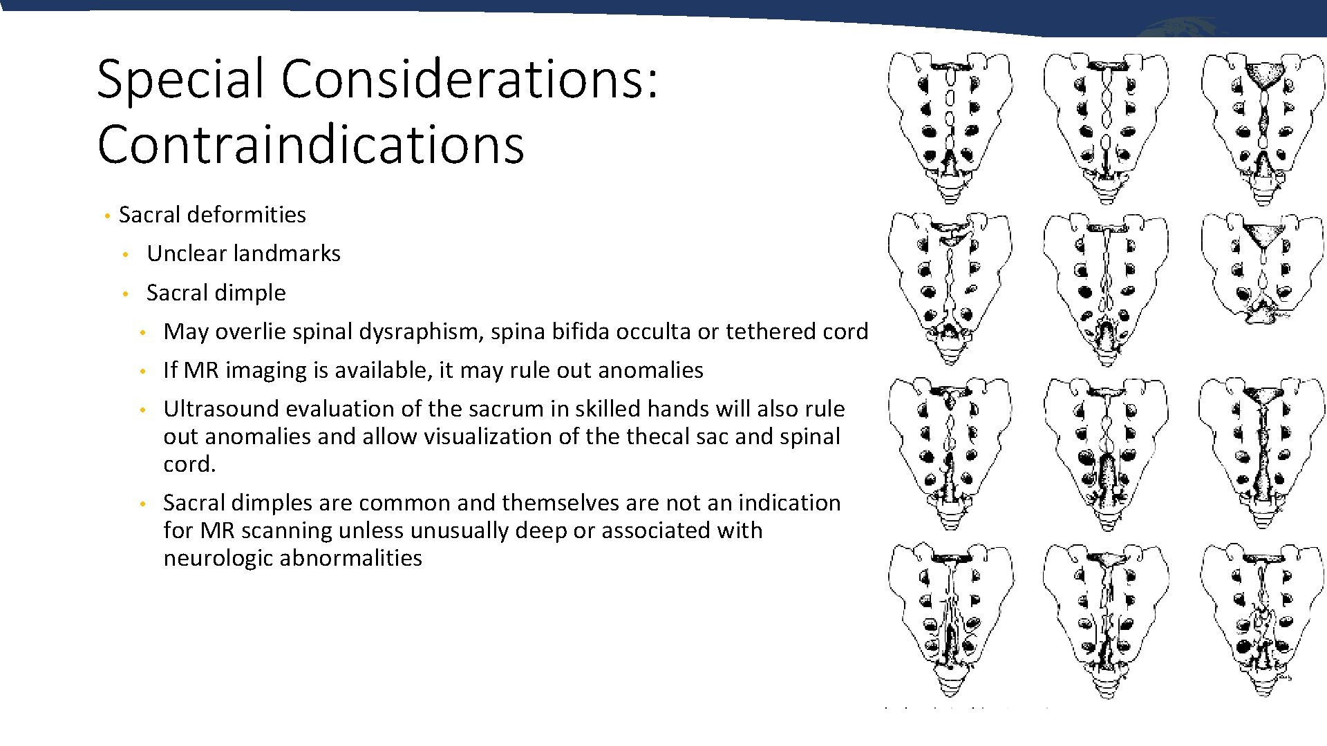 Special Considerations: Contraindications • Sacral deformities • Unclear landmarks • Sacral dimple • May