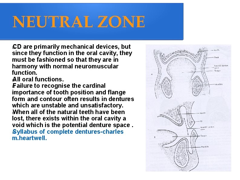 NEUTRAL ZONE CD are primarily mechanical devices, but since they function in the oral