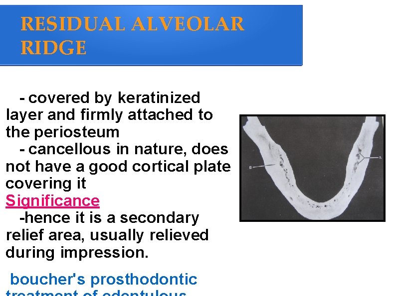 RESIDUAL ALVEOLAR RIDGE - covered by keratinized layer and firmly attached to the periosteum