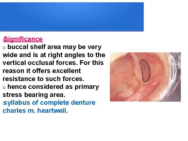 Significance � buccal shelf area may be very wide and is at right angles