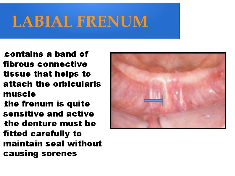 LABIAL FRENUM contains a band of fibrous connective tissue that helps to attach the