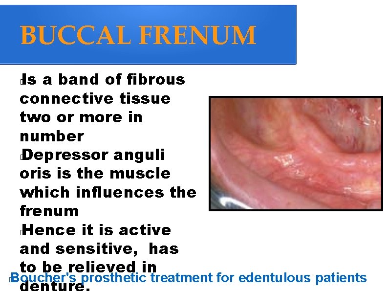 BUCCAL FRENUM Is a band of fibrous connective tissue two or more in number