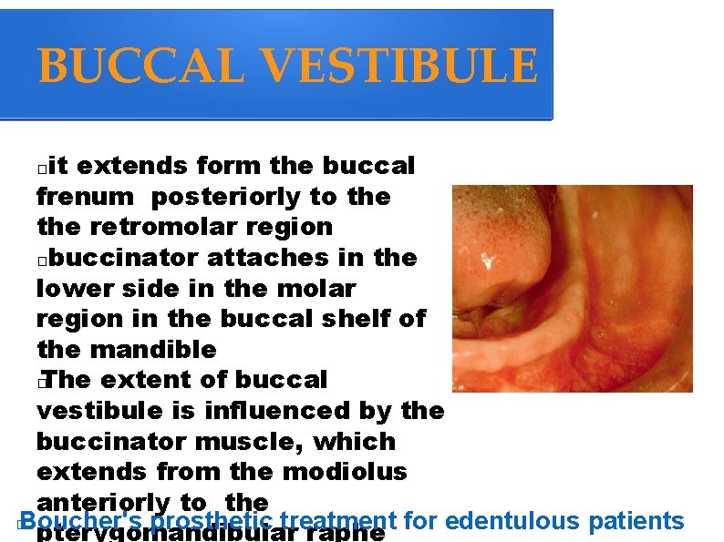 BUCCAL VESTIBULE it extends form the buccal frenum posteriorly to the retromolar region �buccinator