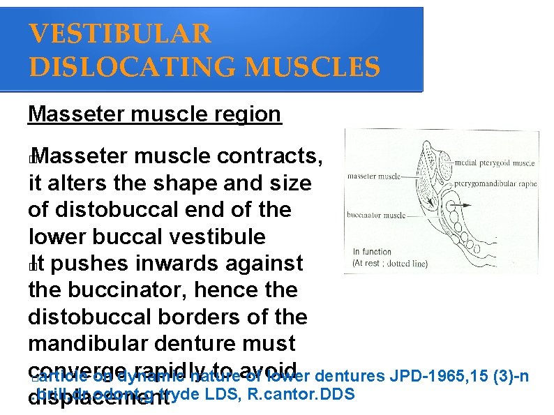 VESTIBULAR DISLOCATING MUSCLES Masseter muscle region Masseter muscle contracts, it alters the shape and