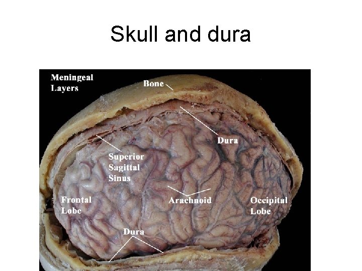 Skull and dura 