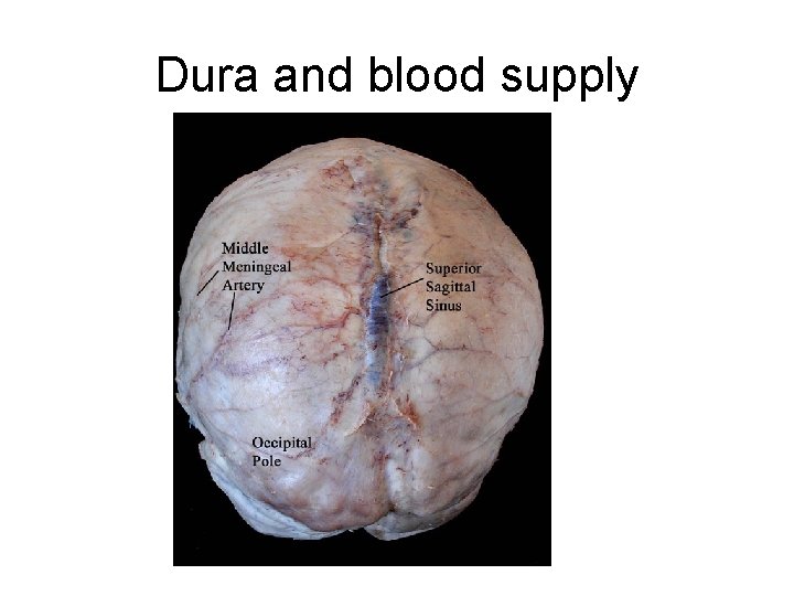 Dura and blood supply 