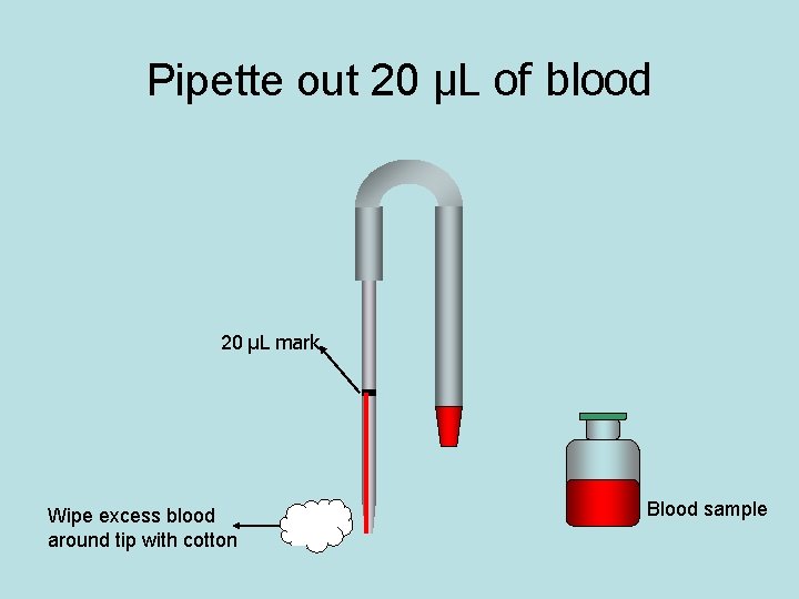 Pipette out 20 μL of blood 20 μL mark Wipe excess blood around tip