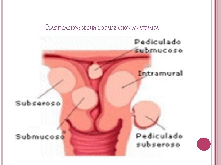 CLASIFICACIÓN: SEGÚN LOCALIZACIÓN ANATÓMICA 