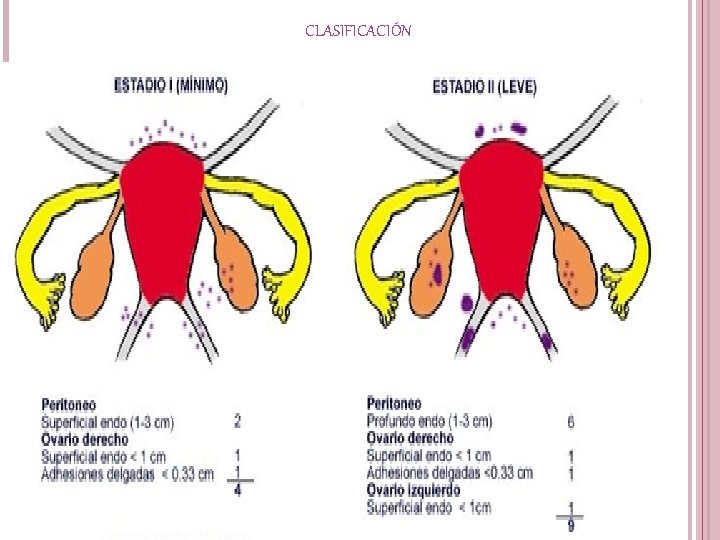 CLASIFICACIÓN 
