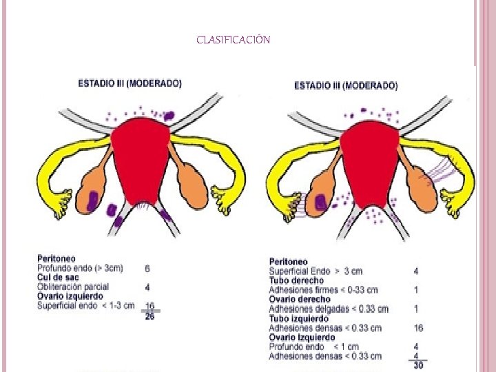 CLASIFICACIÓN 