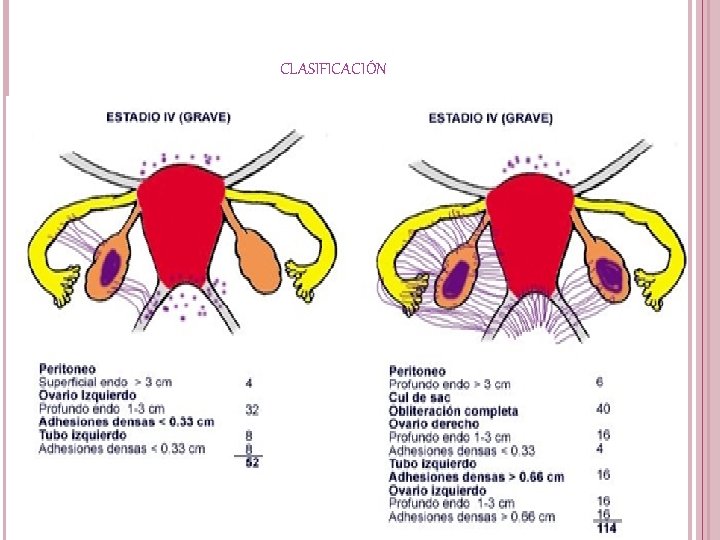 CLASIFICACIÓN 
