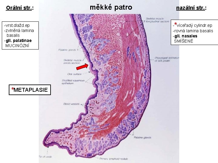 Orální str. : -vrst. dlažd. ep -zvlněná lamina basalis -gll. palatinae MUCINÓZNÍ *METAPLASIE měkké