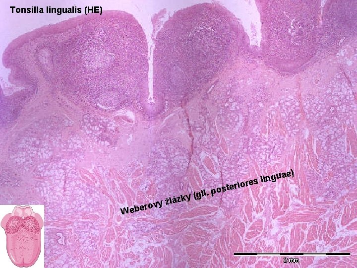 Tonsilla lingualis (HE) e) rio lá ste o p. l l zky (g W