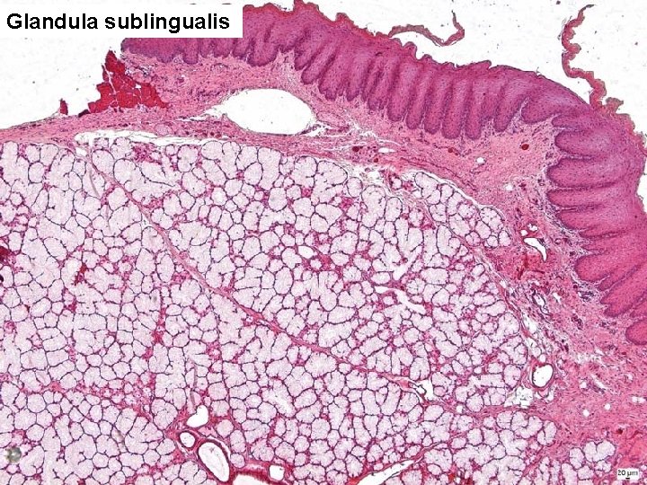 Glandula sublingualis 