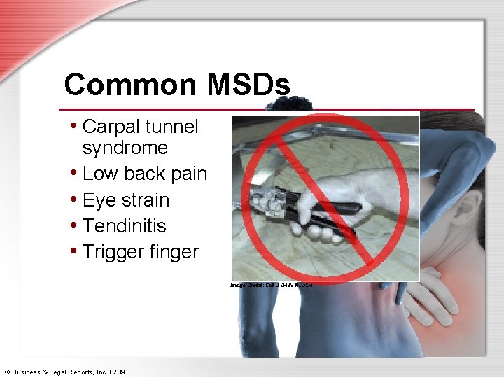 Common MSDs • Carpal tunnel syndrome • Low back pain • Eye strain •