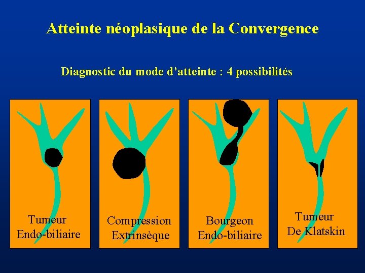 Atteinte néoplasique de la Convergence Diagnostic du mode d’atteinte : 4 possibilités Tumeur Endo-biliaire