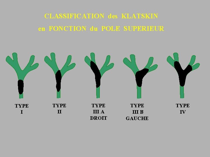 CLASSIFICATION des KLATSKIN en FONCTION du POLE SUPERIEUR TYPE III A DROIT TYPE III