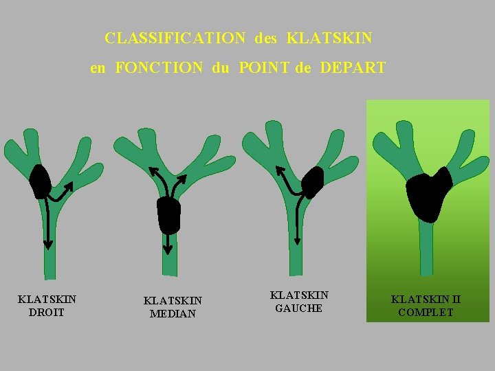 CLASSIFICATION des KLATSKIN en FONCTION du POINT de DEPART KLATSKIN DROIT KLATSKIN MEDIAN KLATSKIN