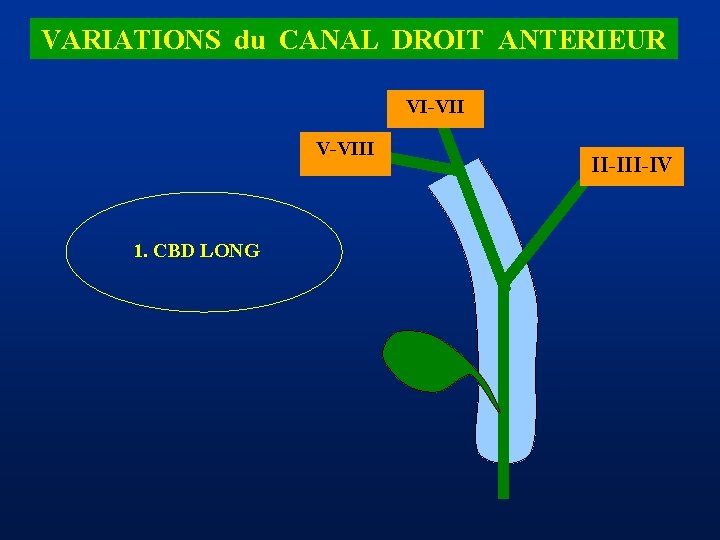 VARIATIONS du CANAL DROIT ANTERIEUR VI-VII V-VIII 1. CBD LONG II-IV 