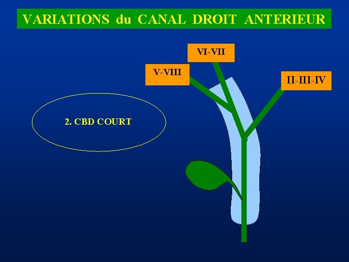 VARIATIONS du CANAL DROIT ANTERIEUR VI-VII V-VIII 2. CBD COURT II-IV 