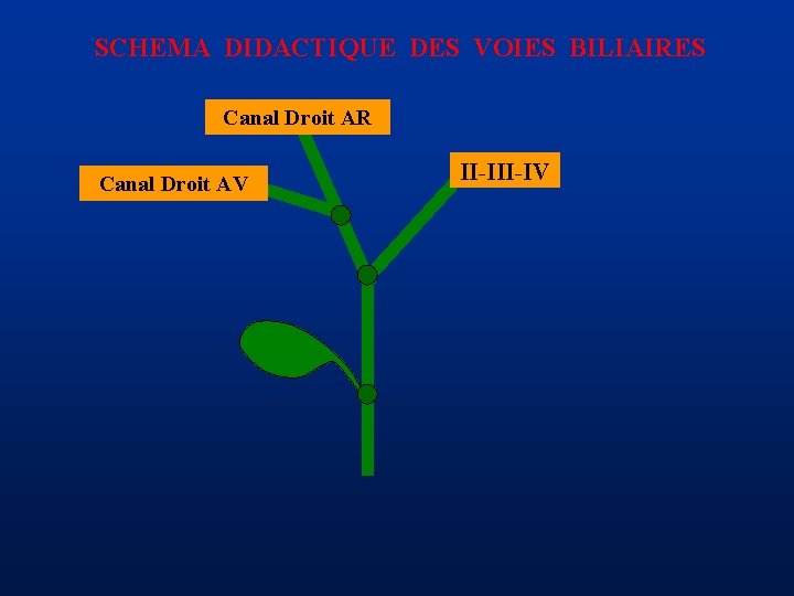 SCHEMA DIDACTIQUE DES VOIES BILIAIRES Canal Droit AR Canal Droit AV II-IV 