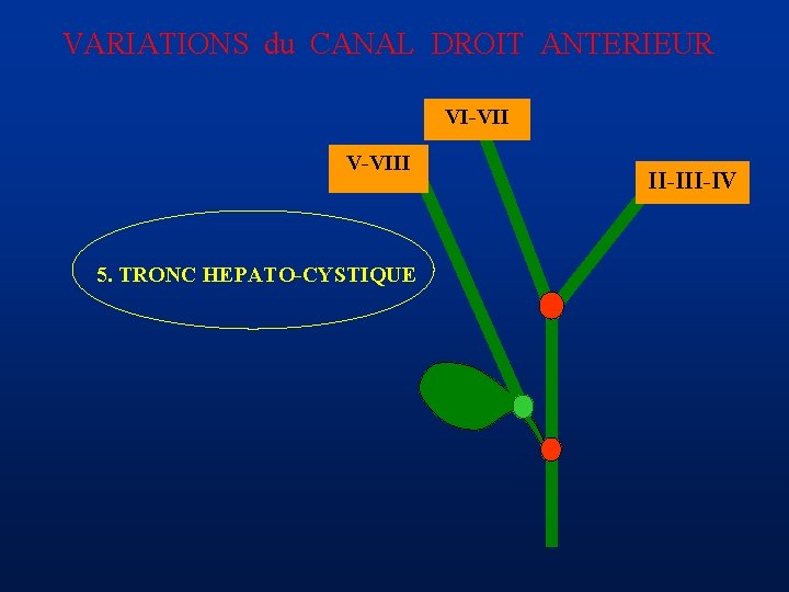 VARIATIONS du CANAL DROIT ANTERIEUR VI-VII V-VIII 5. TRONC HEPATO-CYSTIQUE II-IV 