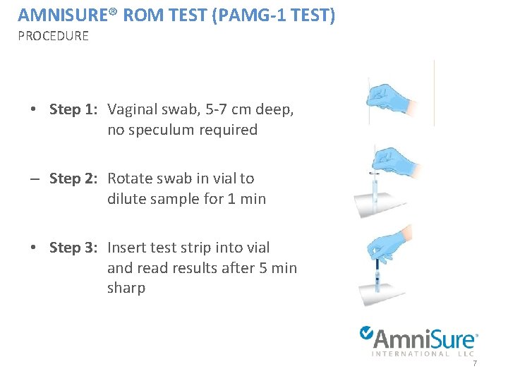AMNISURE® ROM TEST (PAMG-1 TEST) PROCEDURE • Step 1: Vaginal swab, 5 -7 cm