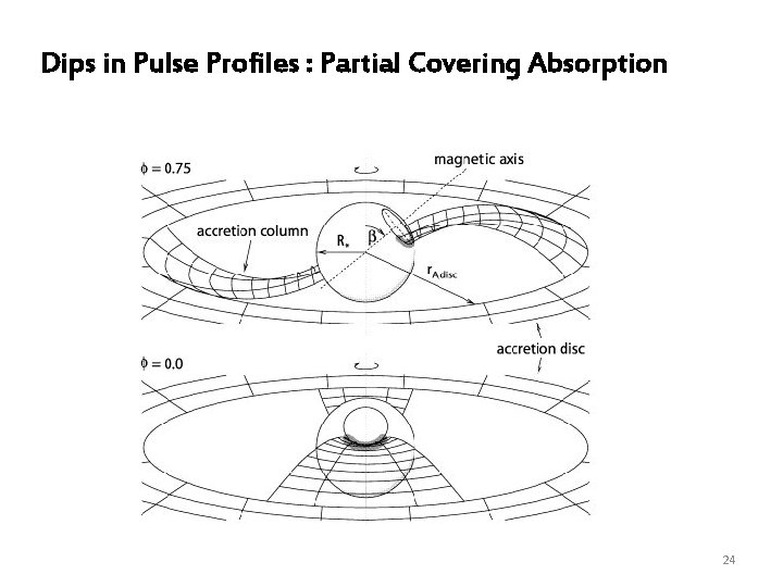 Dips in Pulse Profiles : Partial Covering Absorption 24 
