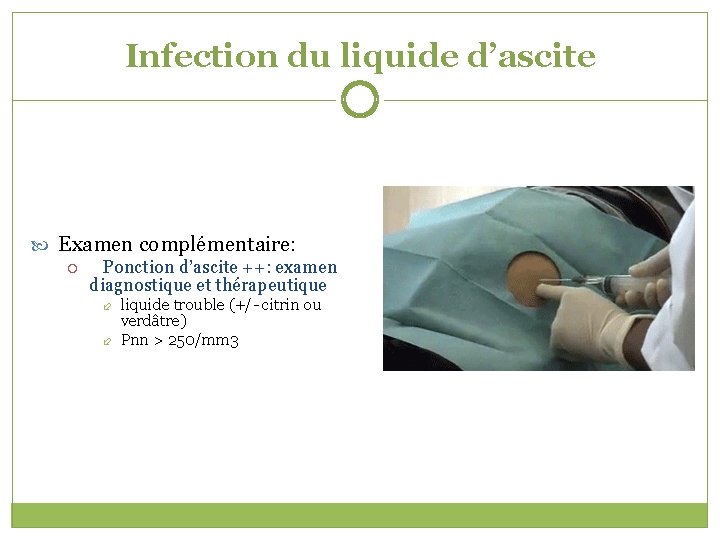 Infection du liquide d’ascite Examen complémentaire: Ponction d’ascite ++: examen diagnostique et thérapeutique liquide