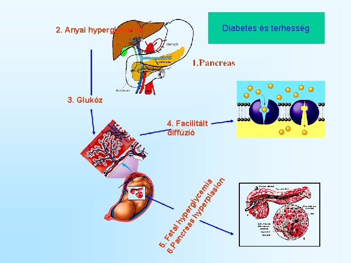 Diabetes és terhesség 2. Anyai hyperglycemia 3. Glukóz 5. 6. P Fet an al