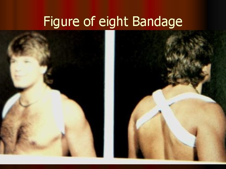 Figure of eight Bandage 