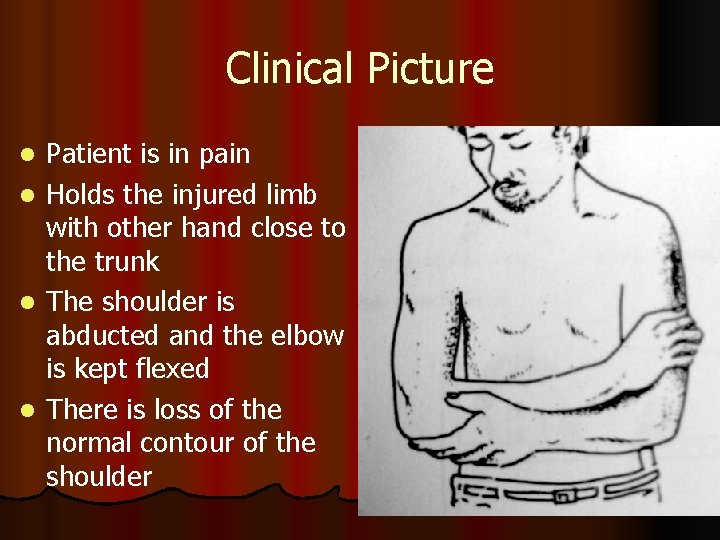 Clinical Picture l l Patient is in pain Holds the injured limb with other