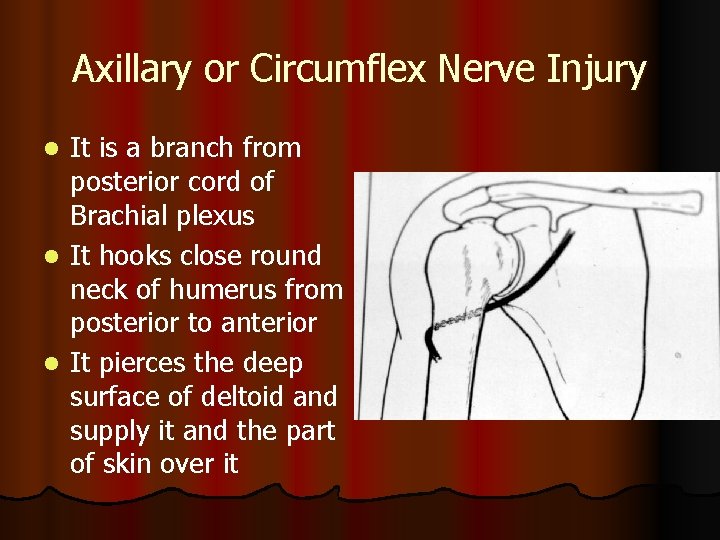 Axillary or Circumflex Nerve Injury It is a branch from posterior cord of Brachial