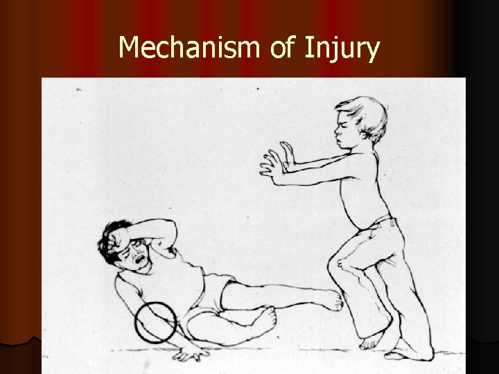 Mechanism of Injury 