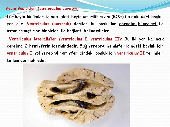 Beyin Boşlukları (ventriculus cerebri) Tümbeyin bölümleri içinde içleri beyin omurilik sıvısı (BOS) ile dolu