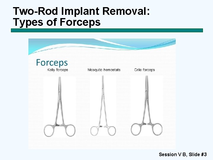 Contraceptive Implants Session V B TwoRod Implant Removal
