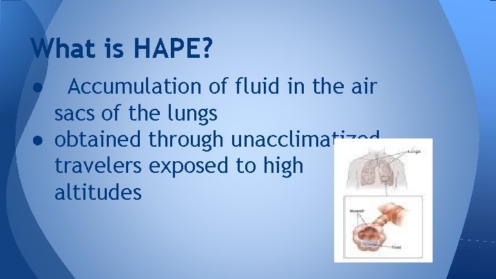 What is HAPE? Accumulation of fluid in the air sacs of the lungs ●