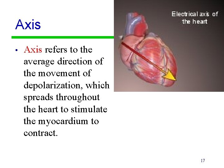 Axis • Axis refers to the average direction of the movement of depolarization, which